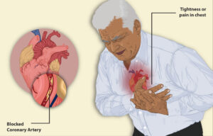 Why heart attack comes