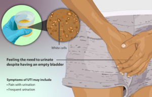 How dangerous is foam in urine?