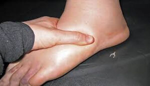 swelling and tingling in the legs