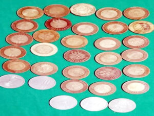 33 coins taken out from young man's stomach